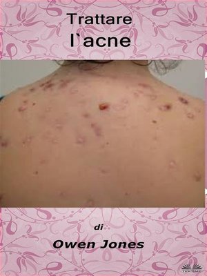 cover image of Trattare L'Acne
